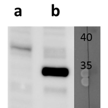Anti-ORF13 (VZV) antibody
