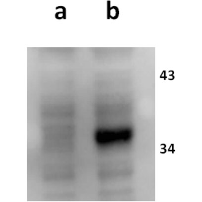 Anti-ORF18 (VZV) antibody