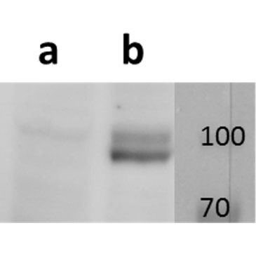 Anti-ORF19 (VZV) antibody