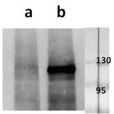 Anti-ORF21 (VZV) antibody