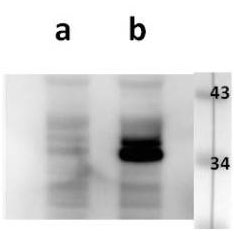 Anti-ORF23 (VZV) antibody