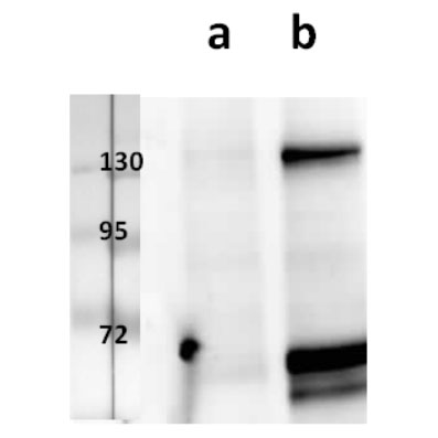 Anti-ORF31/gB (VZV) antibody