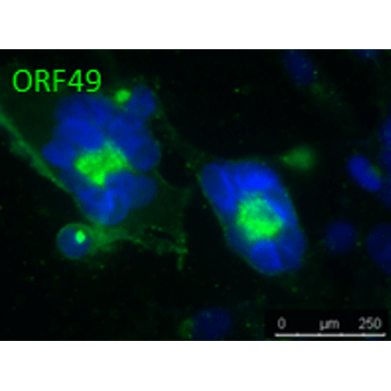 Anti-ORF49 (VZV) antibody