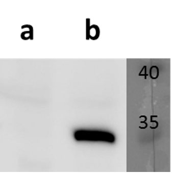 Anti-ORF7 (VZV) antibody