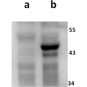 Anti-ORF8 (VZV) antibody