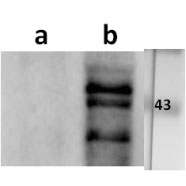 Anti-ORF9 (VZV) antibody