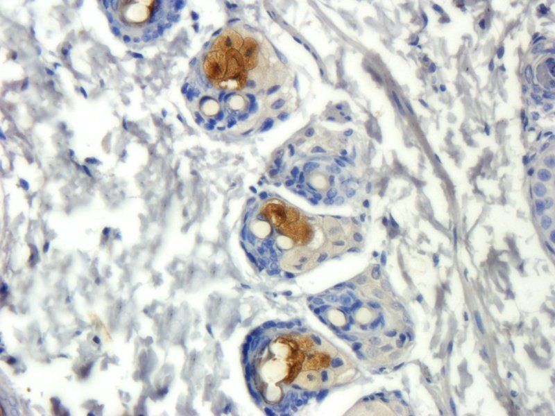ORM1 Mouse Monoclonal Antibody