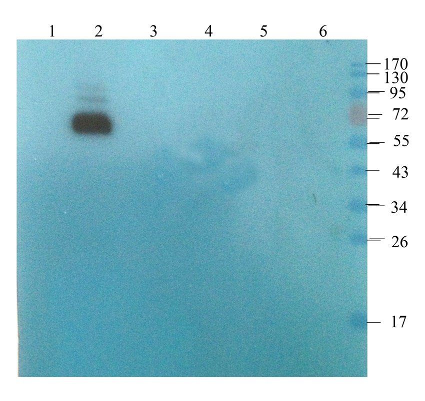 ORM1 Mouse Monoclonal Antibody