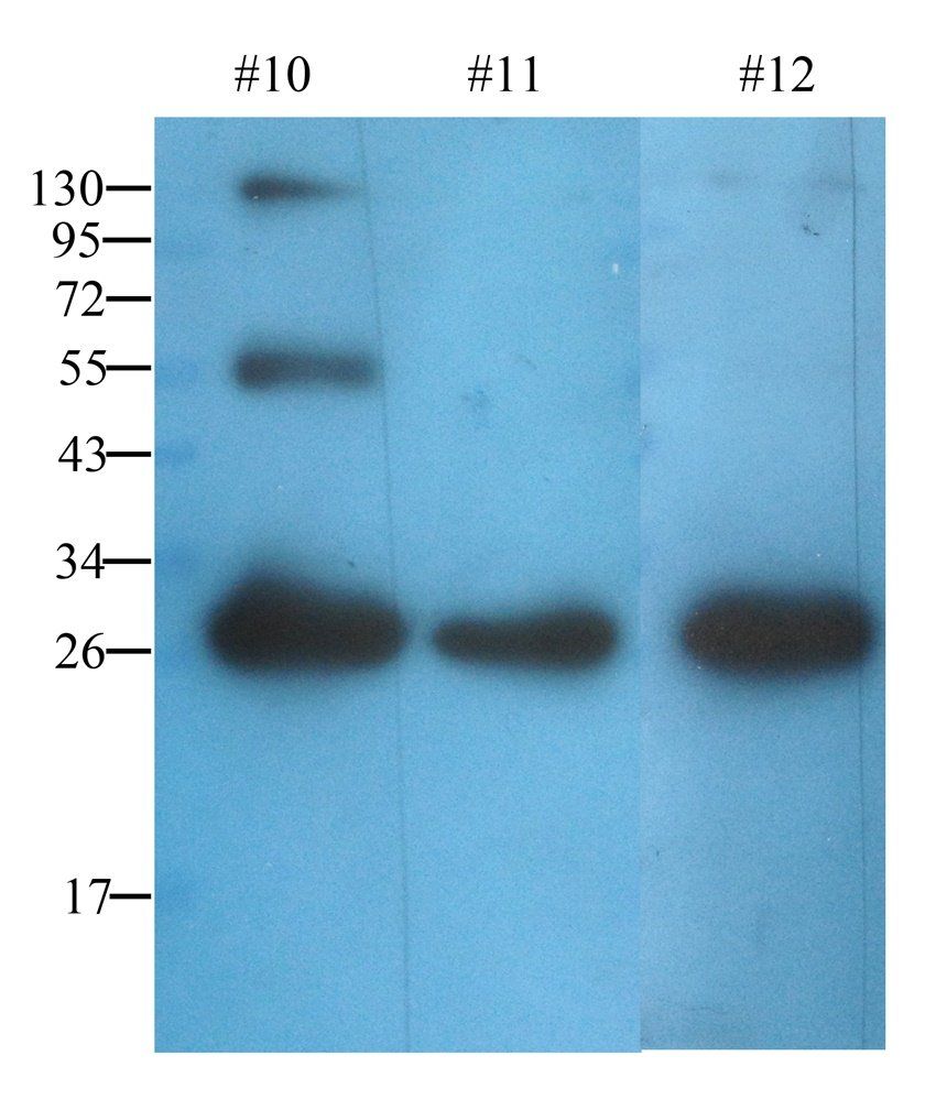 ORM1 Mouse Monoclonal Antibody