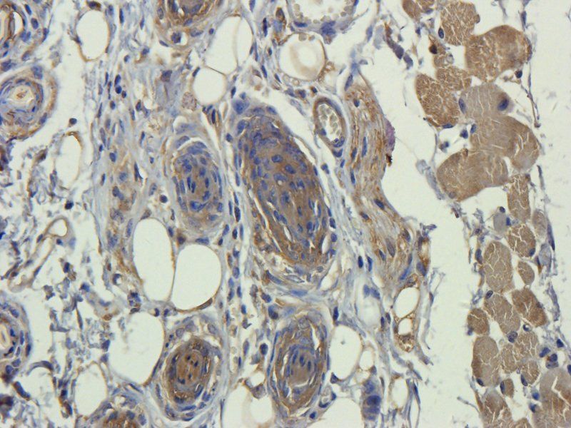 ORM1 Rabbit Polyclonal Antibody