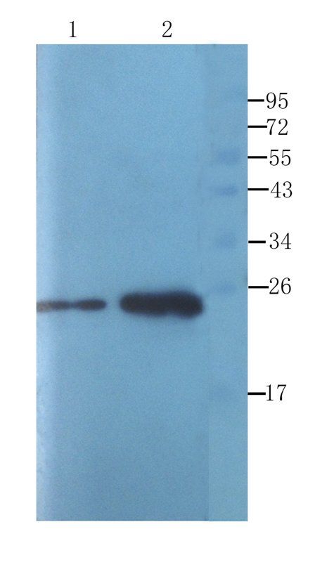 ORM1 Rabbit Polyclonal Antibody