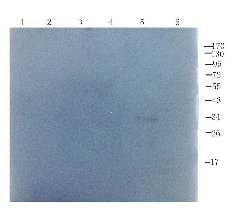 ORM1 Rabbit Polyclonal Antibody