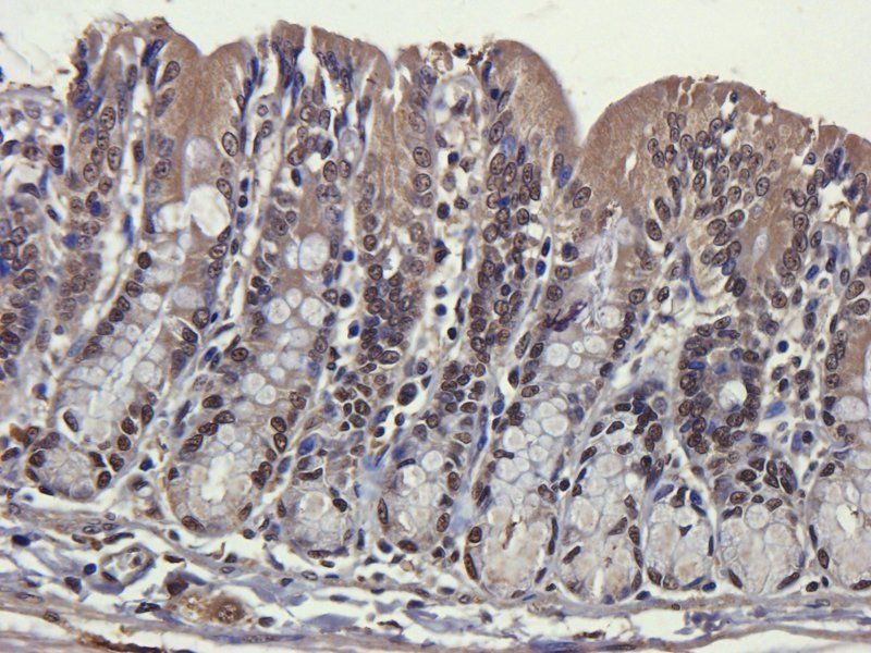 ORM1 Rabbit Polyclonal Antibody