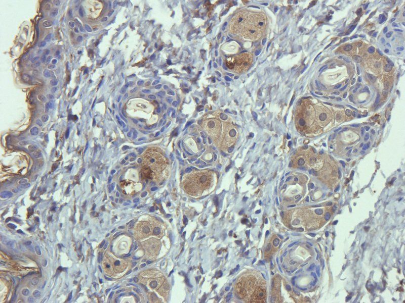 ORM1 Rabbit Polyclonal Antibody