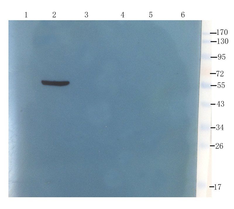 ORM1 Rabbit Polyclonal Antibody