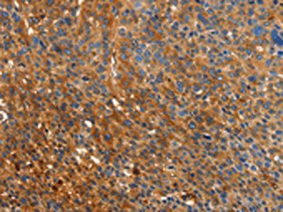 ORM2 Antibody