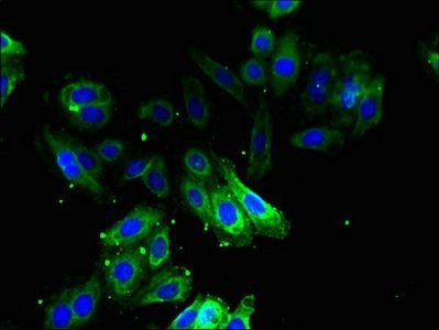 ODC1 Antibody