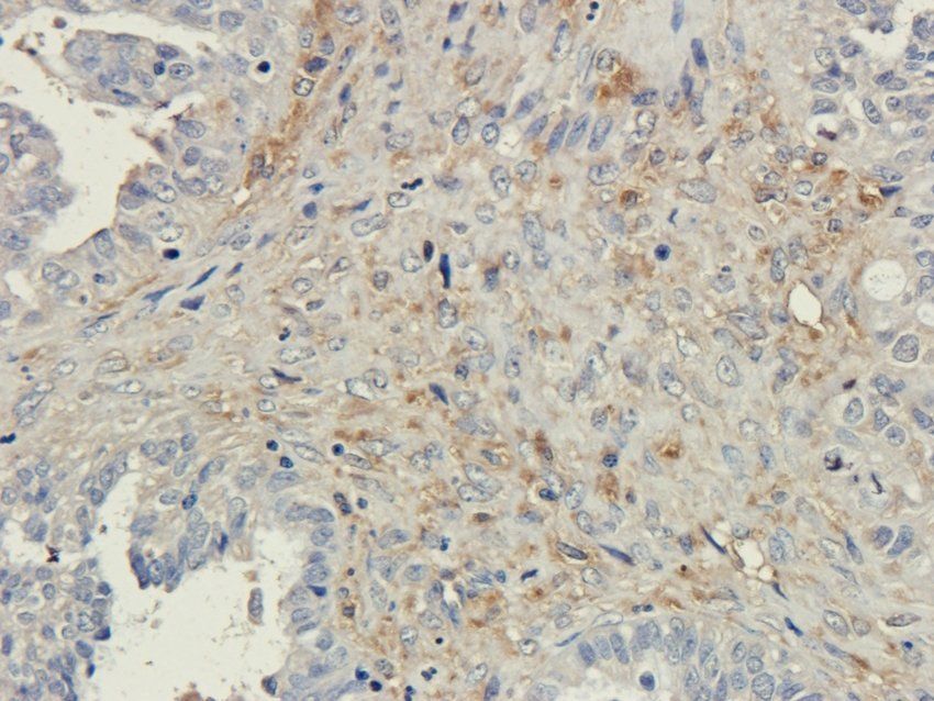 Osteopontin Rabbit Polyclonal Antibody