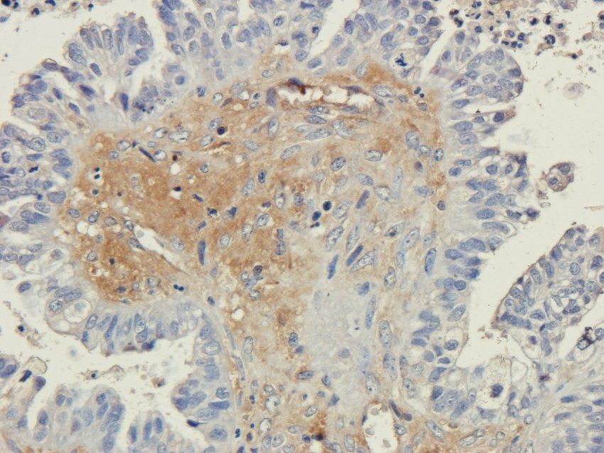 Osteopontin Rabbit Polyclonal Antibody