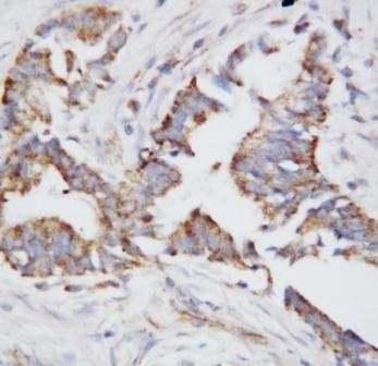 Osteopontin/SPP1 Rabbit Polyclonal Antibody