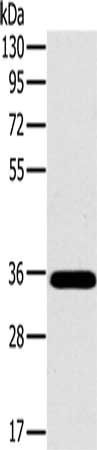 OTUB1 Antibody