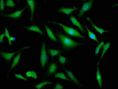 OTUD7B Antibody