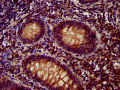 OTUD7B Antibody