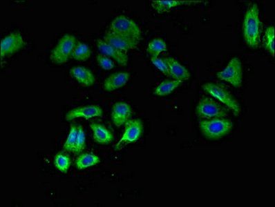 OXTR Antibody