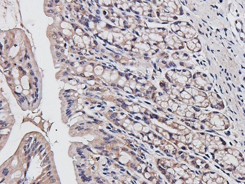 p-Selectin Rabbit Polyclonal Antibody
