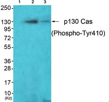 p130 Cas (Phospho-Tyr410) Antibody