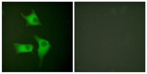 p15 INK Antibody