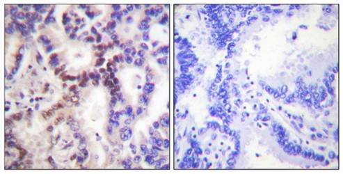p15 INK Antibody