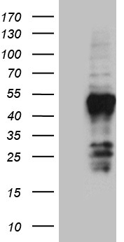 p16INK4A Antibody