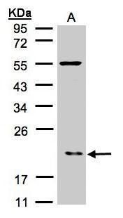 actin related protein 2/3 complex subunit 3 Antibody