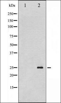 Phospho-p21 Cip1 (Thr145) Antibody
