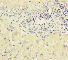 P2RX3 Antibody