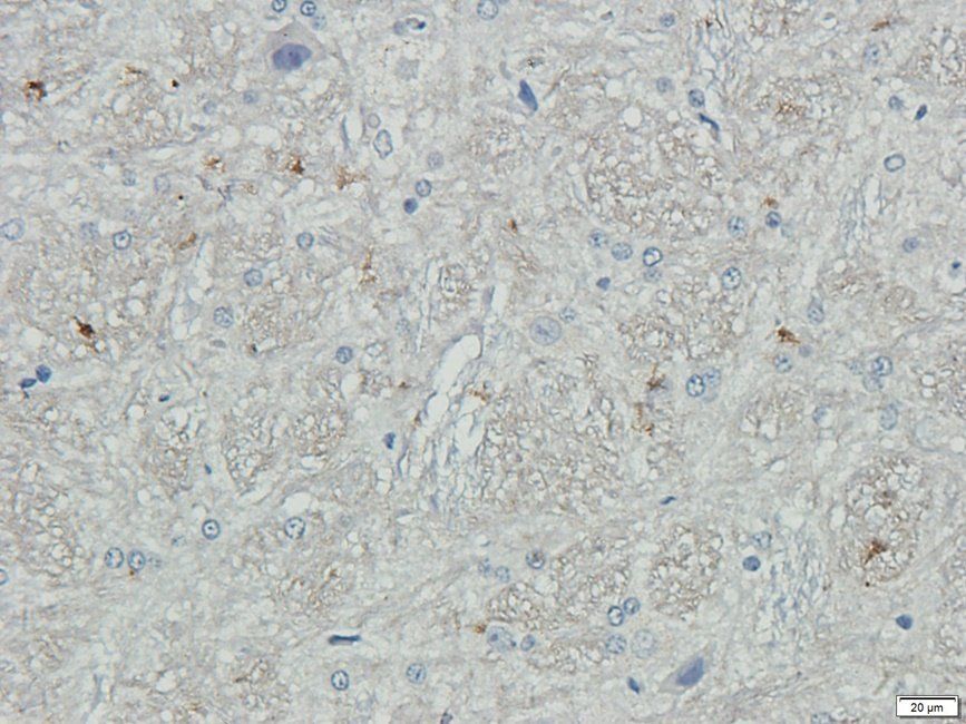 P2RX4 Rabbit Polyclonal Antibody