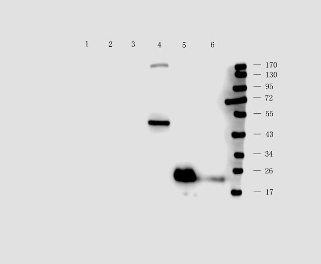 P2RX4 Rabbit Polyclonal Antibody