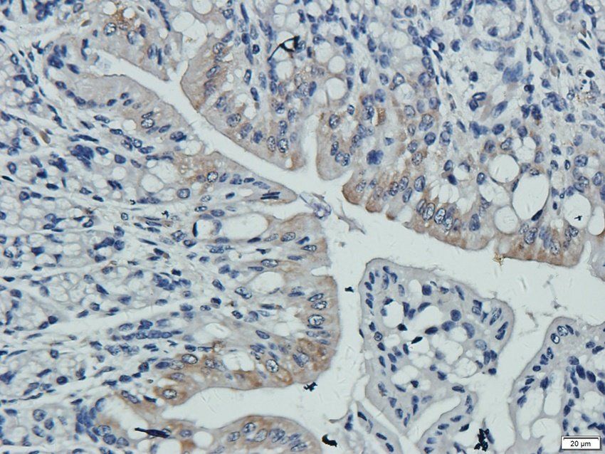 P2RX4 Rabbit Polyclonal Antibody