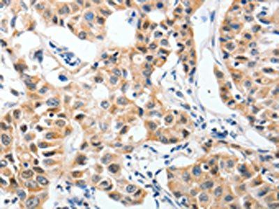 P2RY6 Antibody