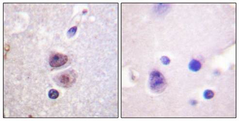p38 MAPK (Ab-322) Antibody