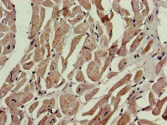 P4HA1 Antibody