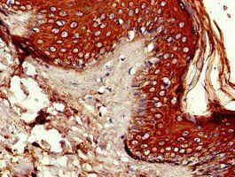 P4HA1 Antibody