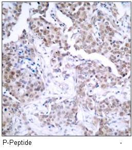 p53 (Phospho-Ser15) Antibody