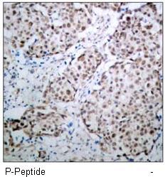 p53 (Phospho-Ser315) Antibody