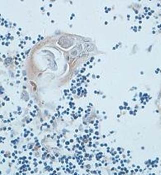 P53AIP1 Rabbit Polyclonal Antibody