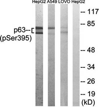 p63 (Phospho-Ser395) Antibody