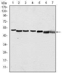 p63a Antibody