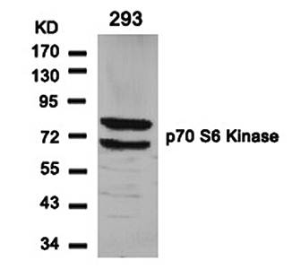 p70 S6 Kinase Rabbit Polyclonal Antibody