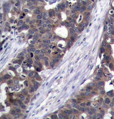 p70 S6 Kinase Rabbit Polyclonal Antibody